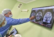 صورة الدماغ أكثر سخونة من الجسم وخاصة عند النساء..فما اسباب ذلك؟