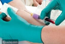 صورة لإظهار مدى حبها… مراهقة تحقن نفسها بدم حبيبها المصاب بالإيدز