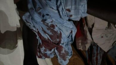 صورة بتلميت: شاب يطعن والده بسكين في حادثة هزت الرأي العام والمحلي